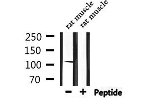 Western blot analysis of extracts from rat muscle, using DSG1 Antibody. (Desmoglein 1 Antikörper  (N-Term))