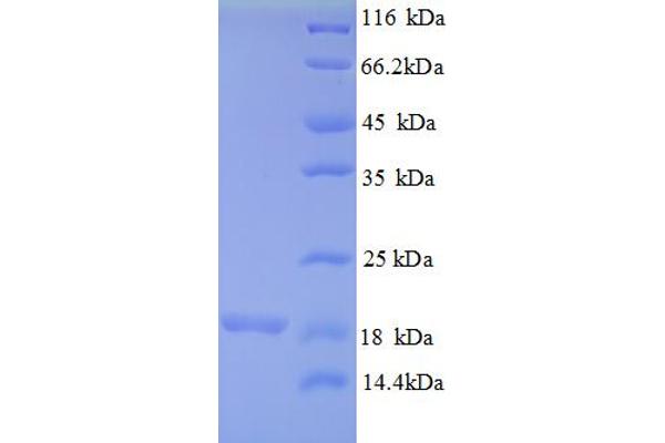 MRPL54 Protein (AA 15-138) (His tag)