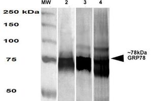 Western Blot analysis of Human, Mouse, Rat HEK-293, NIH3T3, and Rat Brain cell lysates showing detection of GRP78 protein using Mouse Anti-GRP78 Monoclonal Antibody, Clone 3G12-1G11 . (GRP78 Antikörper  (HRP))