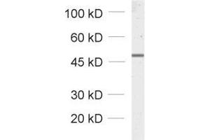 dilution: 1 : 1000, sample: total cell lysate from fibroblasts transfected with a GFP fusion construct (GFP Antikörper)