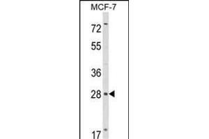 Western blot analysis of RASL11B Antibody (N-term) (ABIN652737 and ABIN2842488) in MCF-7 cell line lysates (35 μg/lane). (RASL11B Antikörper  (N-Term))