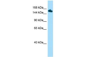 Host:  Rabbit  Target Name:  Setd5  Sample Type:  Mouse Stomach lysates  Antibody Dilution:  1. (SETD5 Antikörper  (C-Term))