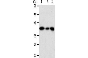 Western Blotting (WB) image for anti-Aldo-Keto Reductase Family 1, Member A1 (Aldehyde Reductase) (AKR1A1) antibody (ABIN2426542) (AKR1A1 Antikörper)