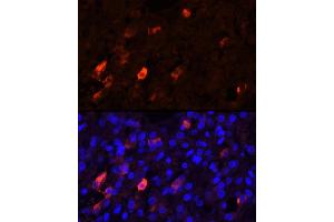 Immunofluorescence analysis of Human adrenal gland cells using PENK Rabbit pAb (ABIN6133151, ABIN6145444, ABIN6145445 and ABIN6221906) at dilution of 1:25 (40x lens). (Enkephalin Antikörper  (AA 25-267))