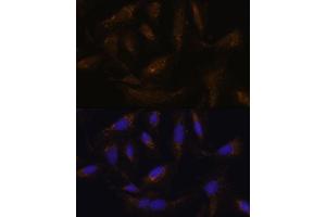 Immunofluorescence analysis of U-2 OS cells using UCP4 antibody (ABIN6132767, ABIN6147925, ABIN6147927 and ABIN6217968) at dilution of 1:100. (SLC25A27 Antikörper  (AA 1-245))