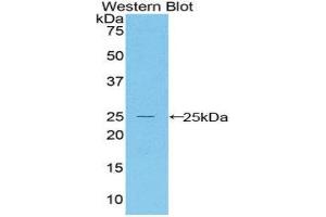 Western Blotting (WB) image for anti-BCL2-Associated X Protein (BAX) (AA 1-158) antibody (ABIN1858117) (BAX Antikörper  (AA 1-158))