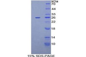 SDS-PAGE analysis of Rat CXCL16 Protein. (CXCL16 Protein)