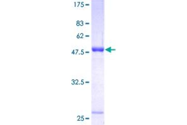 UCHL1 Protein (AA 1-223) (GST tag)