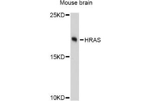Western blot analysis of extracts of mouse brain, using HRAS Antibody (ABIN5997928) at 1:3000 dilution. (HRAS Antikörper)