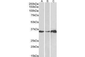 Western Blotting (WB) image for anti-LIM and SH3 Protein 1 (LASP1) antibody (ABIN5921969) (LASP1 Antikörper)