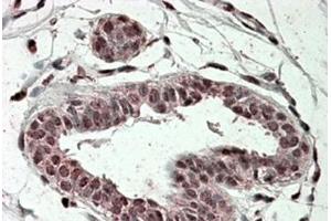 TREX2 Antibody staining of paraffin embedded Human Breast at 3. (TREX2 Antikörper  (Internal Region))