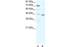 Western Blotting (WB) image for anti-Zfp-1 antibody (ABIN2460391) (Zfp-1 Antikörper)