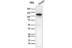 Western blot analysis of Heart tissue lysate using N-Cadherin Mouse Monoclonal Antibody (13A9). (N-Cadherin Antikörper  (Cytoplasmic Domain))