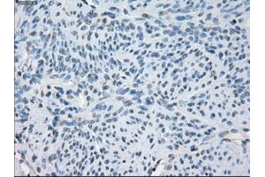 Immunohistochemical staining of paraffin-embedded endometrium tissue using anti-FCGR2A mouse monoclonal antibody. (FCGR2A Antikörper)