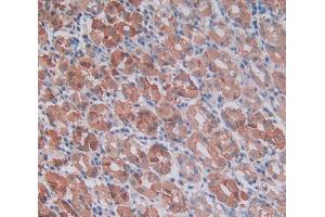 Used in DAB staining on fromalin fixed paraffin- embedded stomach tissue (MMP14 Antikörper  (AA 322-541))