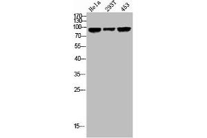 Western Blot analysis of HELA 293T 453 cells using Phospho-GR (S203) Polyclonal Antibody (Glucocorticoid Receptor Antikörper  (pSer203))