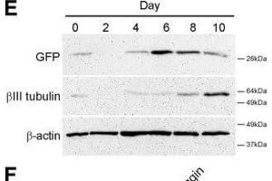 Western Blotting (WB) image for anti-Green Fluorescent Protein (GFP) antibody (ABIN100085)