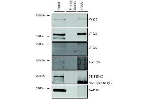 Immunoprecipitation analysis using Mouse Anti-VPS35 Monoclonal Antibody, Clone 10A8 (ABIN6933001). (VPS35 Antikörper  (PerCP))