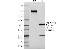 SDS-PAGE Analysis Purified EGFR Mouse Monoclonal Antibody (F4). (EGFR Antikörper  (AA 985-996))