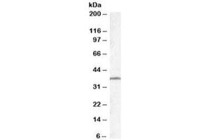 Western blot testing of mouse testis lysate with TSGA2 antibody at 0. (RSPH1 Antikörper)