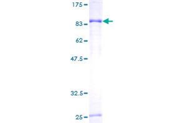 Phosphoglucomutase 3 Protein (PGM3) (AA 1-542) (GST tag)