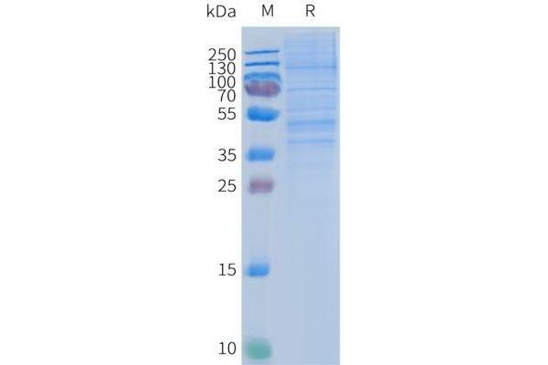 CCR2 Protein