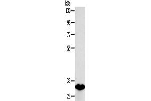 Western Blotting (WB) image for anti-Sulfotransferase Family 1B Member 1 (SULT1B1) antibody (ABIN2424228) (SULT1B1 Antikörper)