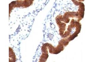 Immunohistochemistry (Formalin-fixed Paraffin-embedded Sections) (IHC (fp)) image for anti-Keratin 19 (KRT19) antibody (ABIN3025850)