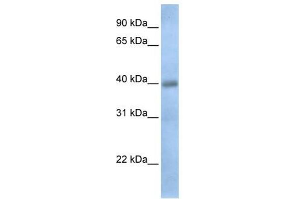 TXNDC15 Antikörper  (C-Term)