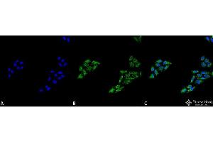 Immunocytochemistry/Immunofluorescence analysis using Rabbit Anti-p53 Polyclonal Antibody . (p53 Antikörper  (C-Term) (HRP))