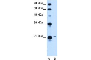 WB Suggested Anti-TCP10L Antibody Titration:  1. (TCP10L Antikörper  (Middle Region))