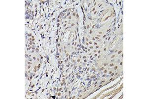 Immunohistochemistry (IHC) image for anti-Ets Variant 4 (ETV4) (AA 1-207) antibody (ABIN6140332)