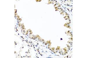 Immunohistochemistry of paraffin-embedded mouse lung using TET2 antibody (ABIN6133019, ABIN6149017, ABIN6149019 and ABIN6221336) at dilution of 1:100 (40x lens). (TET2 Antikörper  (AA 1833-2002))