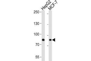 Western Blotting (WB) image for anti-Ubiquitin Specific Peptidase 51 (USP51) antibody (ABIN3004645) (USP51 Antikörper)