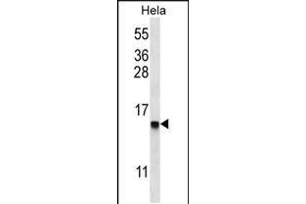 DEFB112 Antikörper  (N-Term)