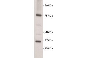 Western Blotting (WB) image for anti-Interleukin 7 Receptor (IL7R) (N-Term) antibody (ABIN1854927) (IL7R Antikörper  (N-Term))