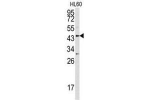 Image no. 1 for anti-Asporin (ASPN) (Middle Region) antibody (ABIN452769) (Asporin Antikörper  (Middle Region))