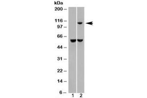 Western blot of HEK293 lysate overexpressing IDE probed with IDE antibody (mock transfection in lane 1). (IDE Antikörper)