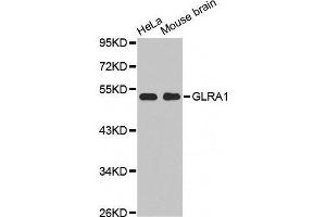 Western Blotting (WB) image for anti-Glycine Receptor, alpha 1 (GLRA1) (AA 29-247) antibody (ABIN6219938) (GLRA1 Antikörper  (AA 29-247))