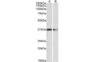 ABIN2564722 (2µg/ml) staining of Mouse (A) and Rat (B) Brain lysates (35µg protein in RIPA buffer). (PRMT2 Antikörper  (Internal Region))