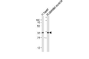 Western blot analysis of lysates from human heart and human skeletal muscle tissue lysate (from left to right), using DIO2 Antibody at 1:1000 at each lane. (DIO2 Antikörper  (AA 165-191))