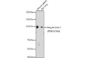 Western blot analysis of extracts of various cell lines, using Integrin beta 3 (ITGB3/CD61) antibody (ABIN6127572, ABIN6142584, ABIN6142586 and ABIN6219636) at 1:1000 dilution. (Integrin beta 3 Antikörper  (AA 610-718))
