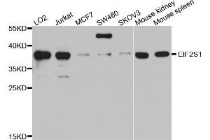Western blot analysis of extracts of various cell lines, using EIF2S1 antibody (ABIN5970287) at 1/1000 dilution. (EIF2A Antikörper)