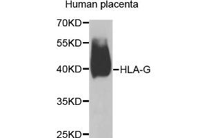 Western blot analysis of extracts of human placenta, using HLA-G antibody (ABIN5974455) at 1/1000 dilution. (HLAG Antikörper)