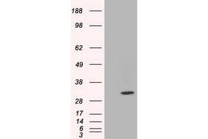 Western Blotting (WB) image for anti-Chromosome 21 Open Reading Frame 59 (C21orf59) antibody (ABIN1497044) (C21orf59 Antikörper)