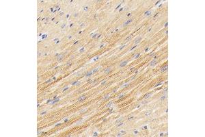 Immunohistochemistry analysis of paraffin embedded mouse heart using PDK3 (ABIN7075334) at dilution of 1: 2000 (PDK3 Antikörper)