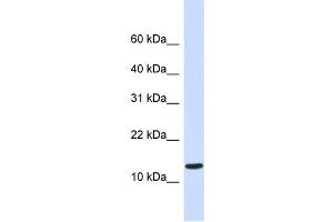 WB Suggested Anti-C1orf95 Antibody Titration:  0. (C1ORF95 Antikörper  (Middle Region))