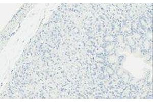 Immunohistochemistry (IHC) image for anti-TLR4 /MD2 Complex antibody (ABIN2665420) (TLR4 /MD2 Complex Antikörper)