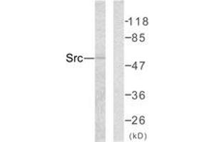 Western Blotting (WB) image for anti-Proto-oncogene tyrosine-protein kinase Src (Src) (AA 386-435) antibody (ABIN2889066) (Src Antikörper  (AA 386-435))