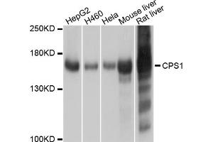 Western blot analysis of extracts of various cell lines, using CPS1 antibody. (CPS1 Antikörper)